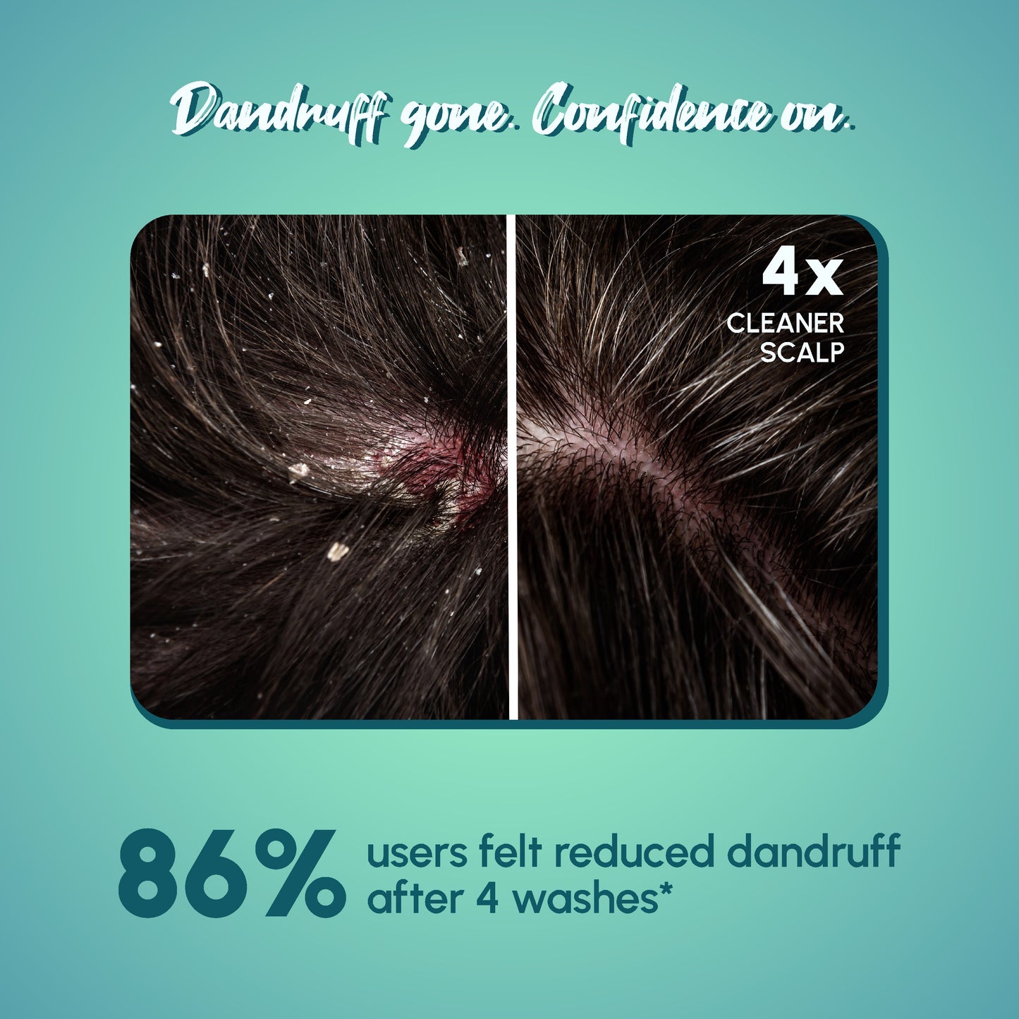 Anti-Dandruff Powder Shampoo